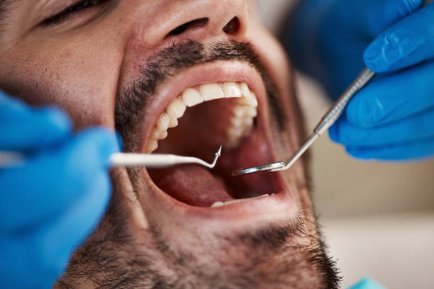 Best Emergency Denture Repair in Lake Holiday, IN
