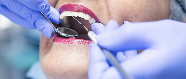 Best Emergency Dental Care for Broken or Chipped Teeth in Lake Holiday, IN