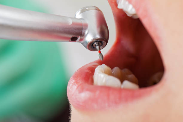 Best Emergency Gum Treatment in Lake Holiday, IN